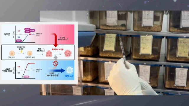 UNIST, 대장암 증식 멈추는 새 항암 표적 발견